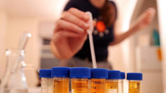 DNA testing