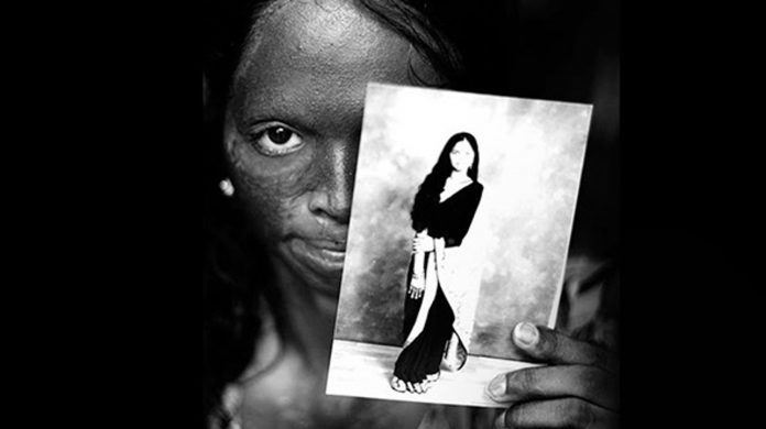 acid attacks
