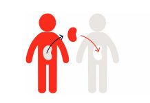 Evaluating the laws governing organ transplantation with respect to the US Organ transplantation