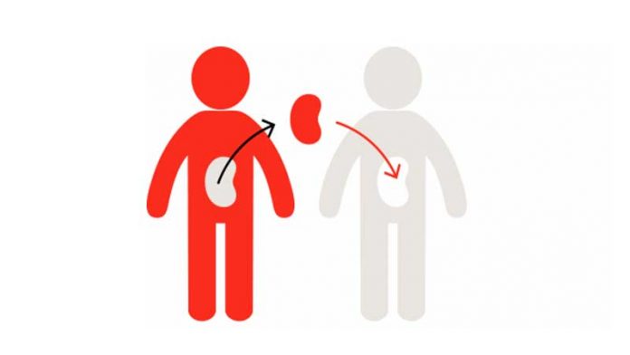 Organ transplantation